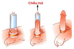 Máy tập dương vật Penis - Giúp cậu nhỏ của phái mạnh 